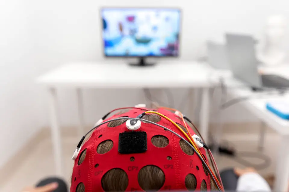 Neurofeedback treatment monitors central nervous system activity with electrodes placed on the scalp. Stock photo