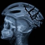 E-bike crashes have become one of the leading causes of traumatic injury among people under 18. The Coast News graphic/AI
